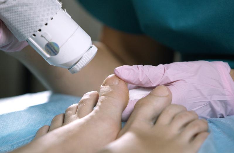 Especialistas en cirugía del pie en Bilbao Bizkaia (Vizcaya) Cirujanos del pie