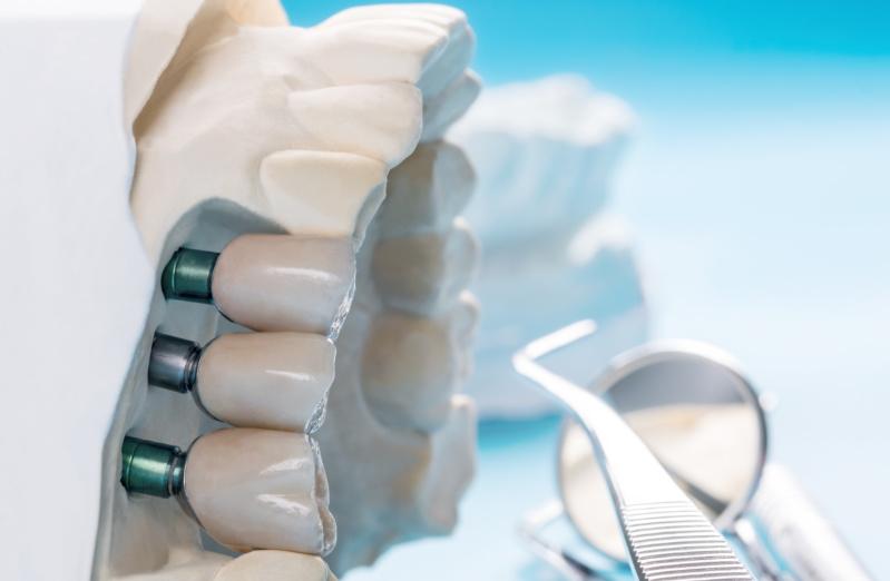 implante dental en Erandio
