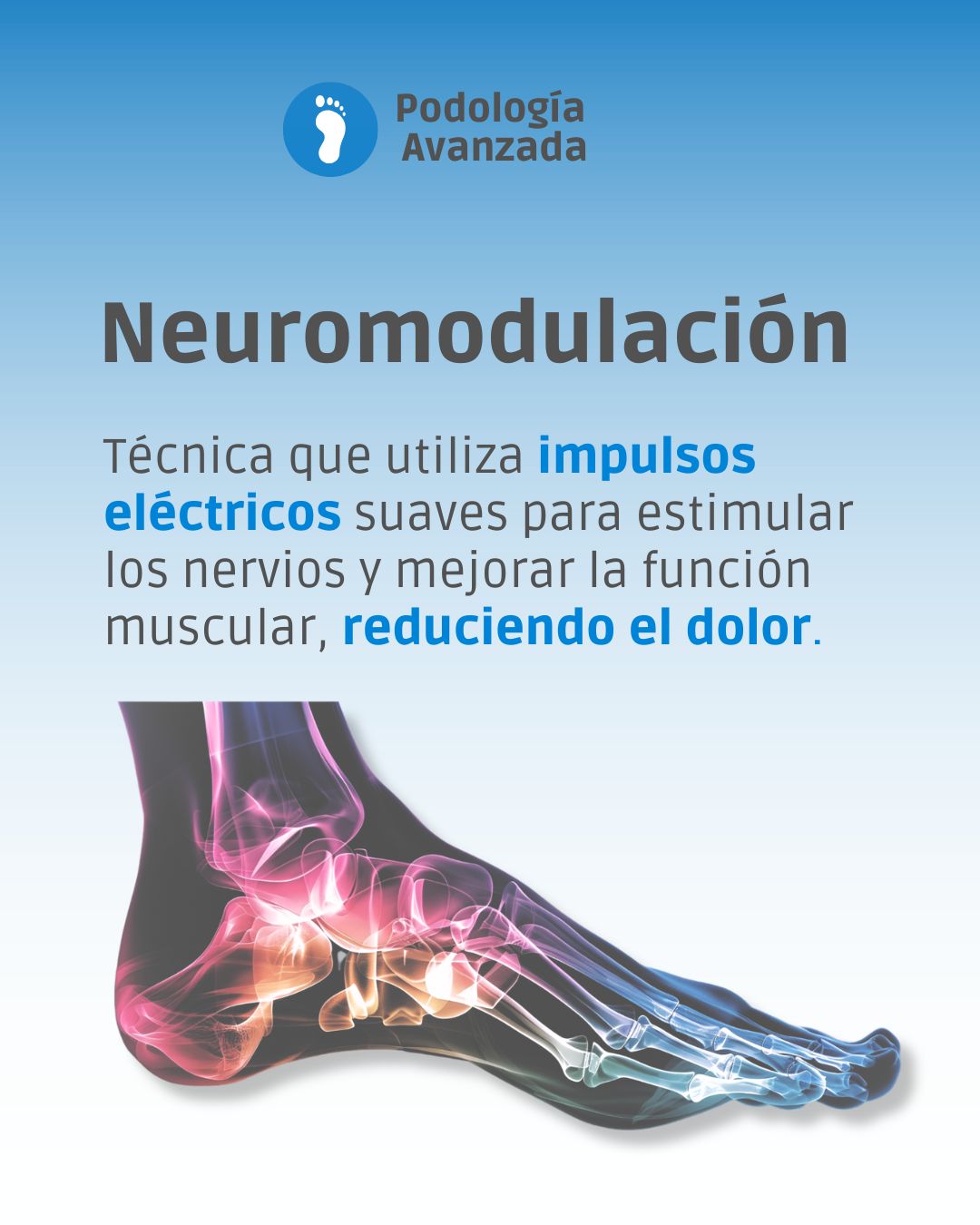 Neuromodulación para el dolor persistente del pie